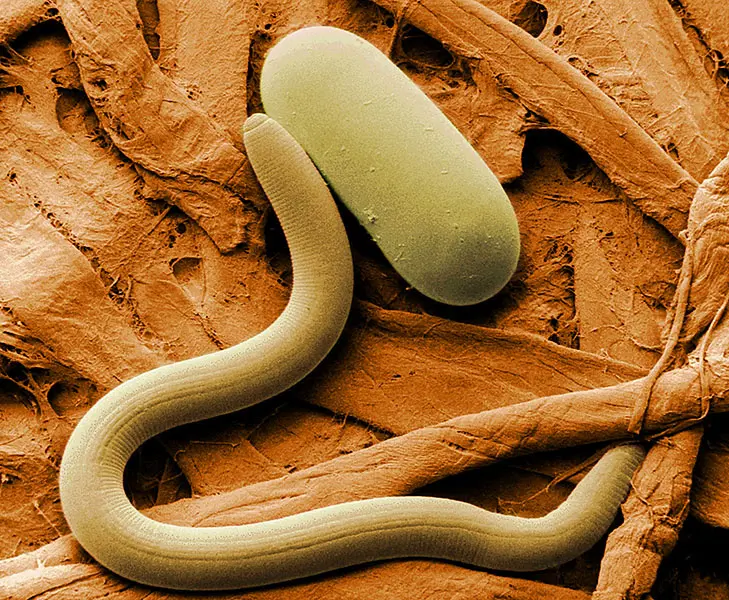 A close-up of a nematode from under a microscope and one of its eggs 