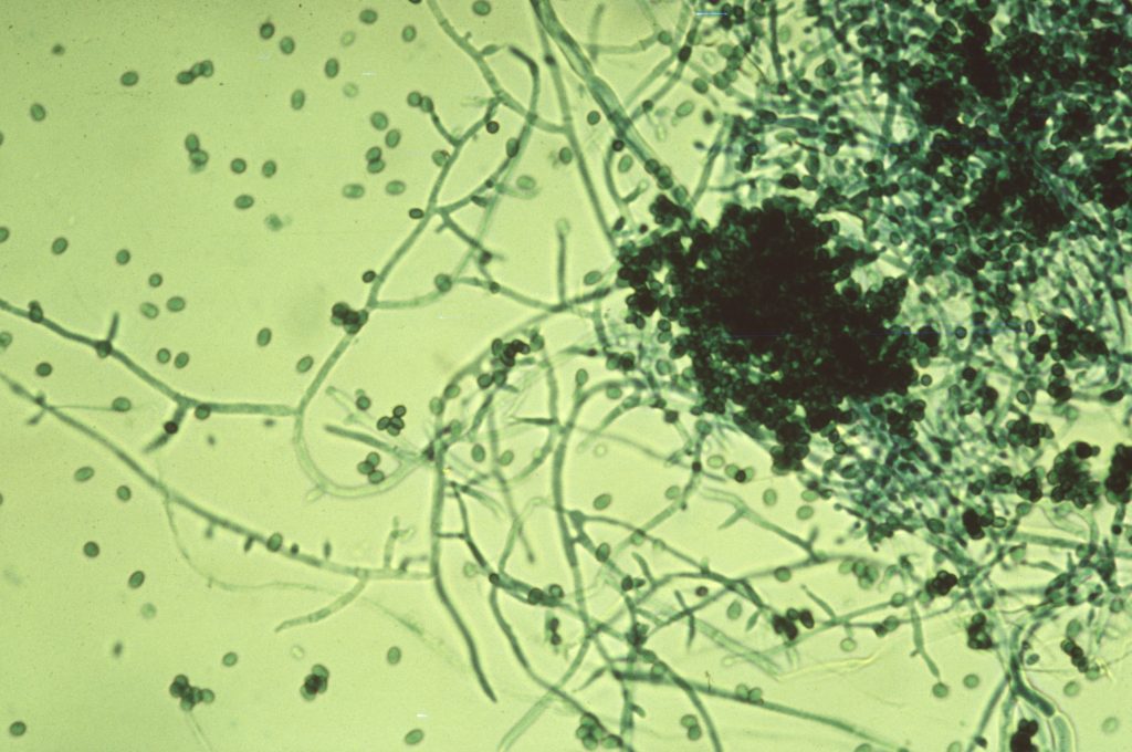 Close do fungo trichoderma sob um microscópio