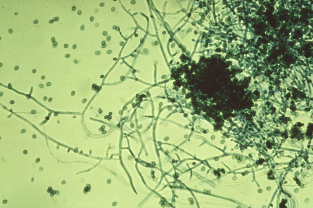 Una vista microscópica de hifas y conidios del hongo Trichoderma viride.