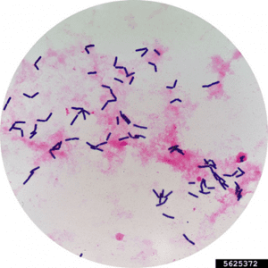 A close-up image of Bacillus thuringiensis under a microscope, showing small purple coloured rods which are the spores